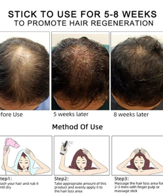 Hair Growth Oil Hair Growth Oil Oem Hair Care Essential Oil
