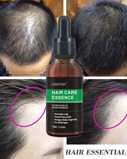 Hair Growth Oil Hair Growth Oil Oem Hair Care Essential Oil