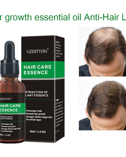 Hair Growth Oil Hair Growth Oil Oem Hair Care Essential Oil