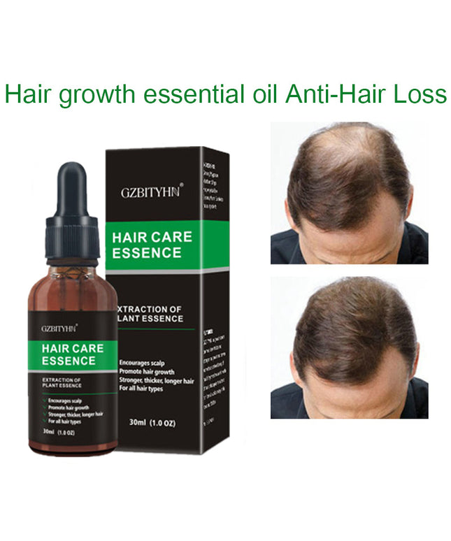 Hair Growth Oil Hair Growth Oil Oem Hair Care Essential Oil