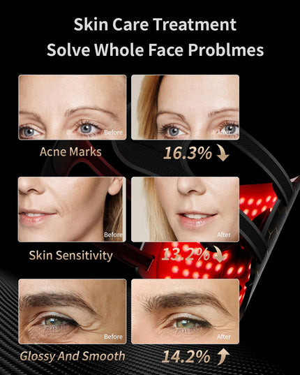 Revitalize Your Skin with the 7-Color LED Anti-Aging Facial Mask - Black